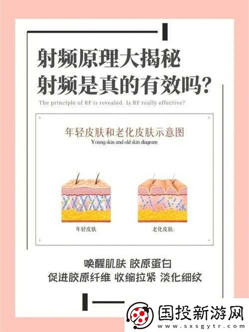 RF射频的原理和作用