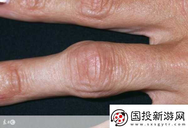 宝宝怎么才三根手指就痛1.宝宝为何三根手指就感到疼痛