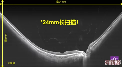 h136.vip红桃视频引发热议