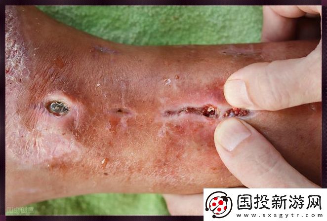 异物的神秘消失