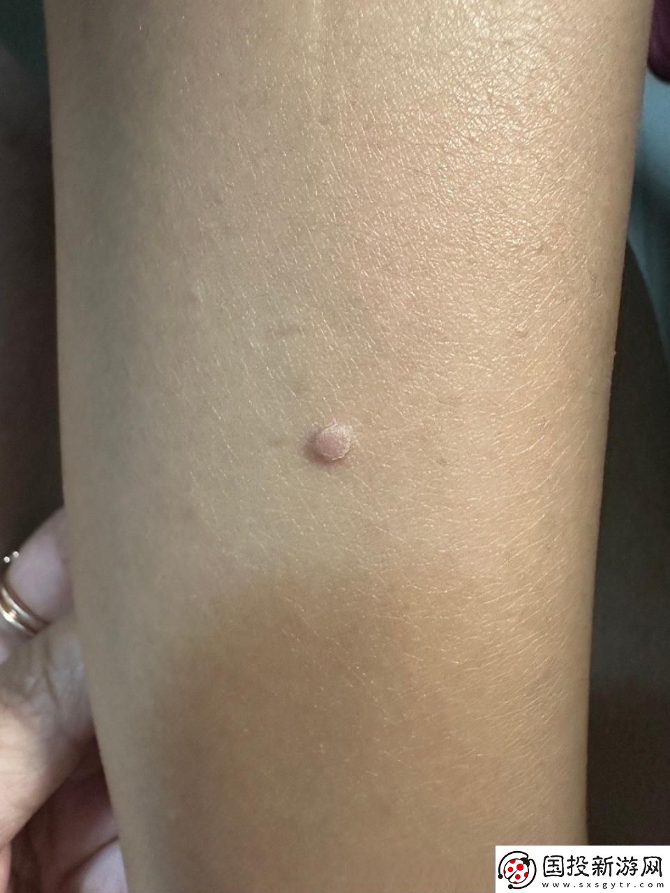 疙瘩里头硬邦邦