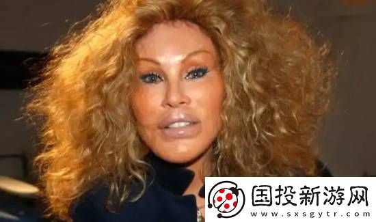 整容成“猫女”的瑞士名媛因心脏衰竭去世
