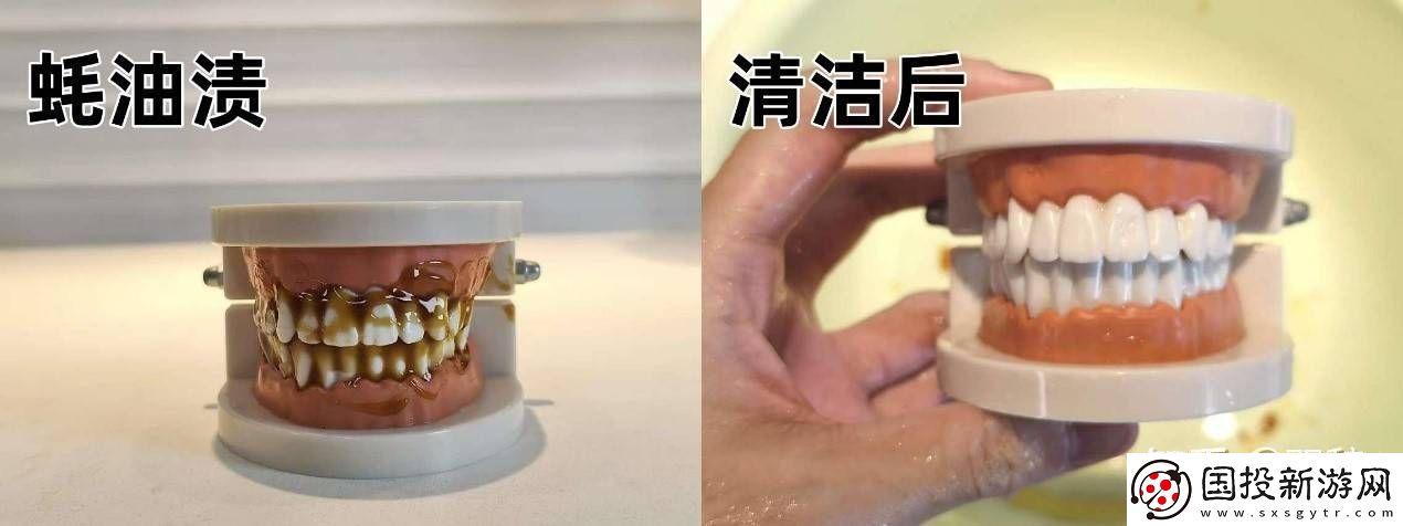 2025年口腔护理新宠！知乎大咖力荐欧可林AirPump