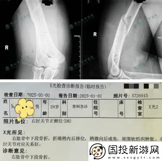 俩小伙挑战与机器人“掰手腕”