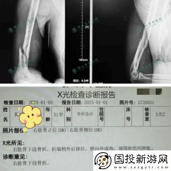 俩小伙挑战与机器人“掰手腕”