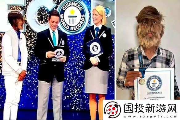 印度少年获“最毛脸”吉尼斯纪录